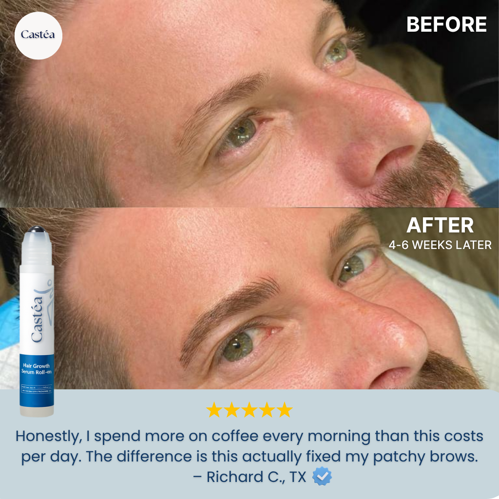 Before and after comparison of a man's face after using Castéa Growth Serum